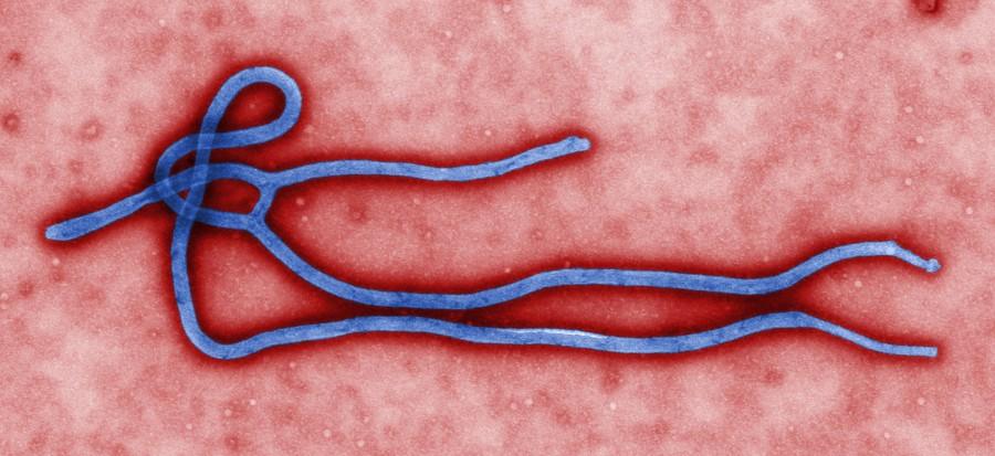The Ebola Virus.